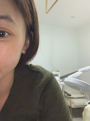 -苗方清颜·祛痘皮肤管理