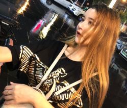 点击看大图 -大麦微针植发丨全国连锁