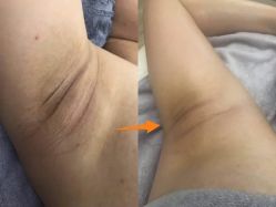 点击看大图 -爱帝宫通乳中心(福田总院)