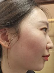 -长沙雅美医疗美容医院