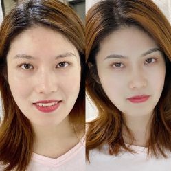 -Doris多里斯半永久纹眉·SMP纹发·发际线