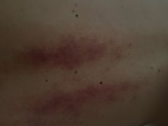 -锦艾·推拿艾灸&疗愈SPA(凯德1818店)