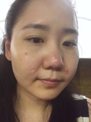 -E.beauty驻颜·痘敏肌调理中心