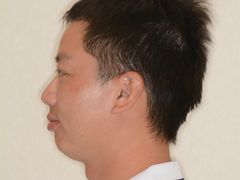 -柏乐口腔(南宁总院)