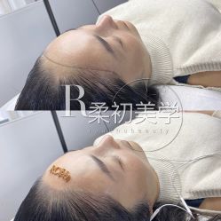 -RC半永久纹眉纹发际线