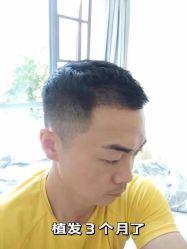 -雍禾植发