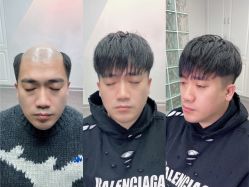 -型男帮男士假发补发·佩戴式发型