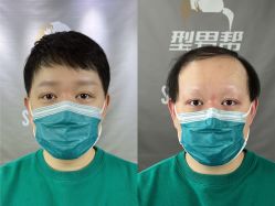 -型男帮男士假发补发·佩戴式发型