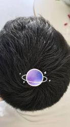 -大麦微针植发丨全国连锁