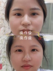 -西施无菌半永久纹绣眉眼影唇轻增发纹发际线