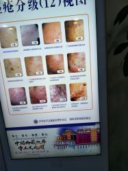 -蕾特恩专业祛痘