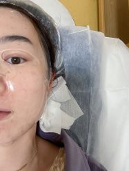 体验后-青岛诺德医学美容医院