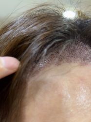 -熙朵美学植发·连锁品牌