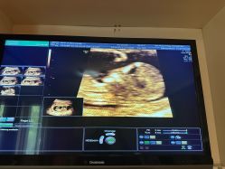 -北京俪婴妇产医院(朝阳大悦城店)