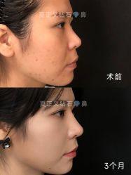 -北京米扬丽格医疗美容·联合丽格鼻整形中心