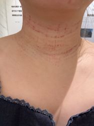 -深圳米兰柏羽医疗美容医院