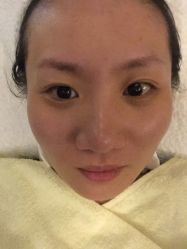 点击看大图 -MedSkinCare科技祛痘肌肤修护中心