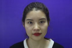 -成都西区医院整形美容
