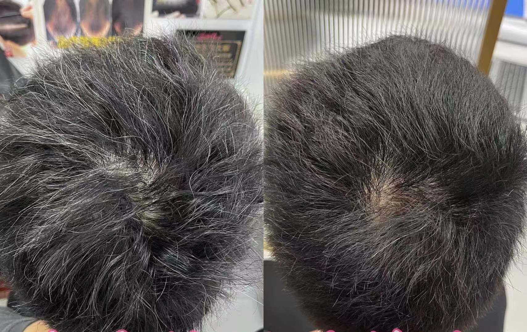 白发转黑