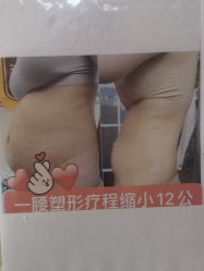 -瘦立方身材管理中心