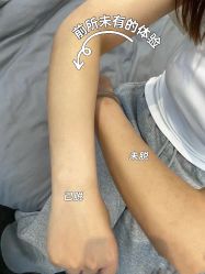 -小梨·OndaPro·专业脱毛连锁机构