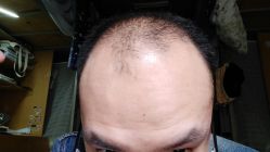 -极客侠男士假发定制补发