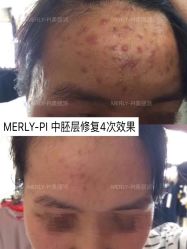 -MLP美丽派·问题肌疗愈中心