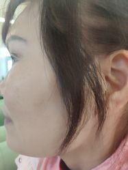 -长沙雅美医疗美容医院