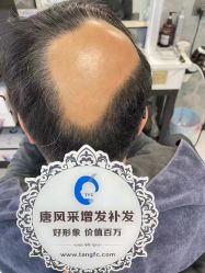 -唐风采假发补发定制