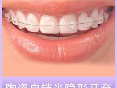 -团圆口腔·种植中心(锦江院区)