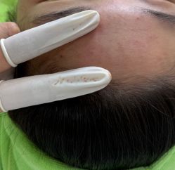 -苗医生科技祛痘连锁