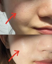 -SKIN79皮肤管理中心