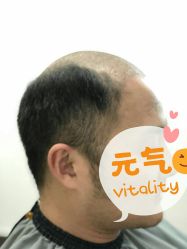 -发饰美男士增发补发假发定制店