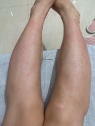 -美莱医疗美容医院