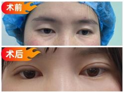 -素美医疗美容·西南眼鼻整形·修复基地
