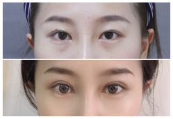 -圣嘉新医疗美容医院