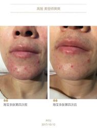 -LUNA皮相美·骨相美高级美感