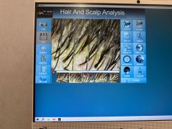 -熙朵美学植发·连锁品牌