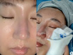 体验后-圣嘉新医疗美容医院