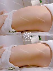 -Fundi张玉珊修身堂·indiba·BTL科技瘦身