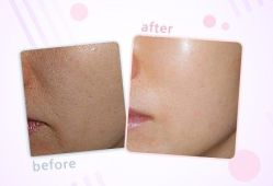 -安徽合肥韩美整形外科医院