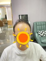 -发饰美男士增发补发假发定制店