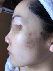 -皇族养心堂·净痘·修敏·御颜