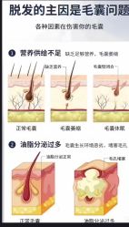 -Bollins波林丝•专研护发中心