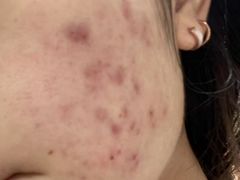 -北京市中关村医院