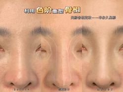 点击看大图 -西施无菌半永久纹绣眉眼影唇轻增发纹发际线