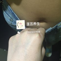 -莲芸拔罐减肥