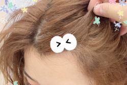 -大麦微针植发全国连锁