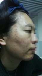 android_upload_pic-Qinskin国际皮肤管理日式整骨中心