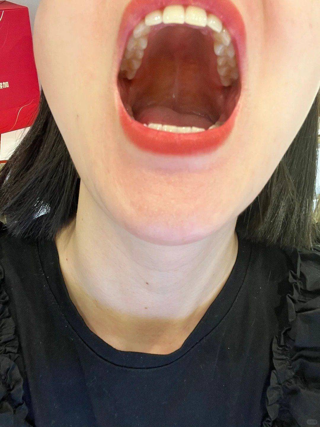 牙齿洁白整齐太重要了!